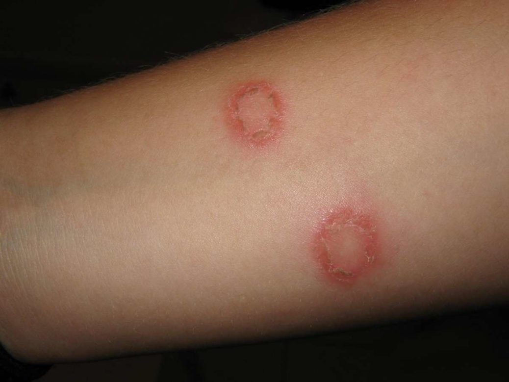 Ringworm in Cats and How to Treat It Louth SPCA
